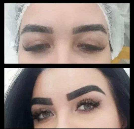 Ани